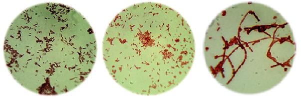 Ake bakterie sa nachazaju v miestnosti kde chovate vtakov